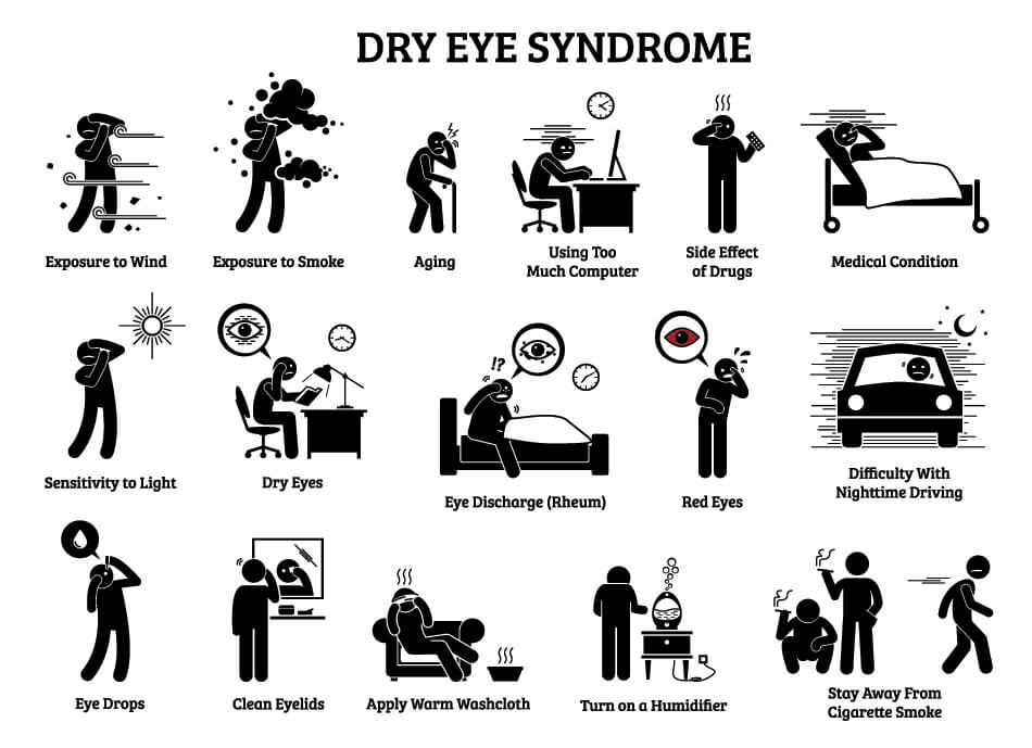 dry eye syndrome infographic