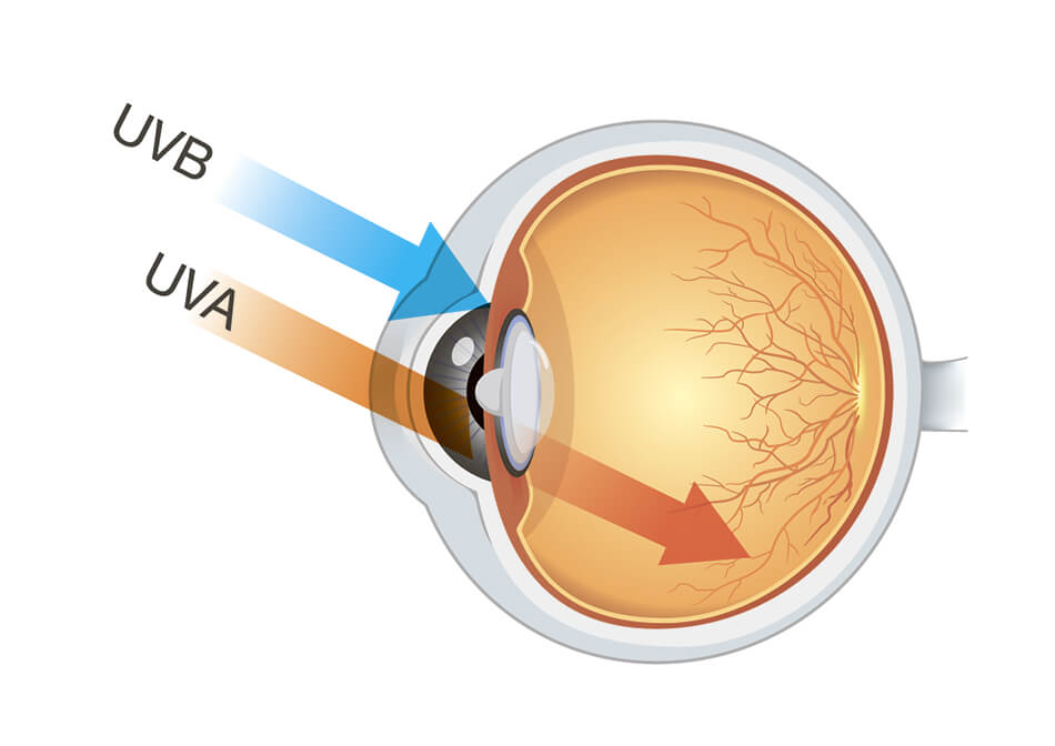 Diagram of eye showing UVB and UVA rays.