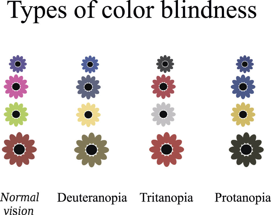 chart comparing colors seen by people with normal vision and colors seen by those with color blindness