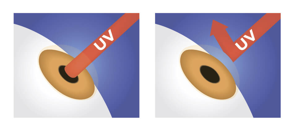 Diagram showing UV rays blocked by contact lenses with uv protection
